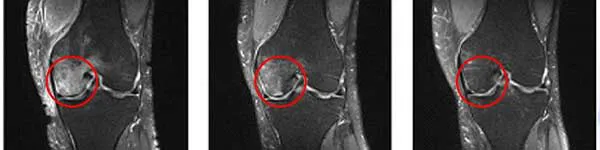 immagine radiografica delle ginocchia