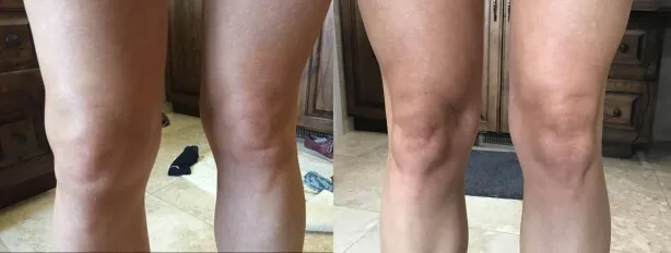 Fotografie di 4 ginocchia