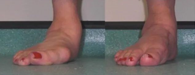 Fotografie dei piedi di una donna