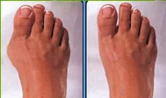 fotografia di 2 piedi