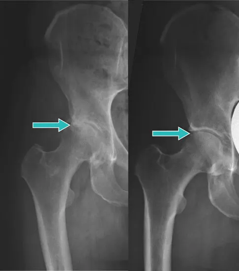 radiografia delle ossa