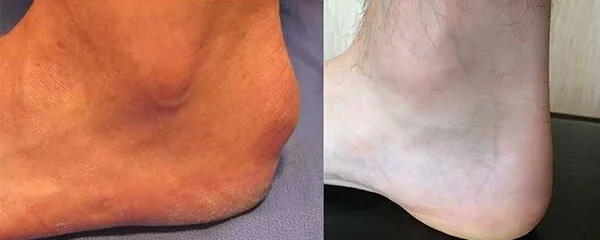 un piede mi fa male e l'altro no